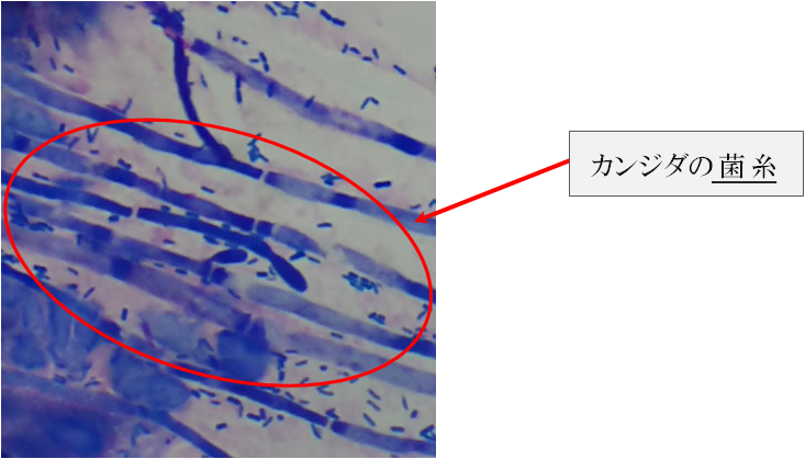 切れ チン 子 た 皮 の