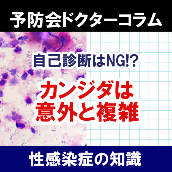 自己診断厳禁！？　意外と複雑な性器カンジダ症